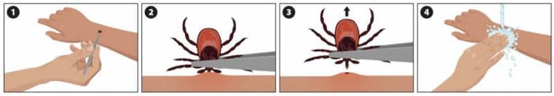 How to properly remove a tick with tweezers