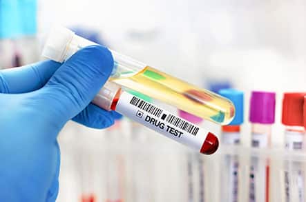 A close up look at two test tubes in a medical lab technician's hand.